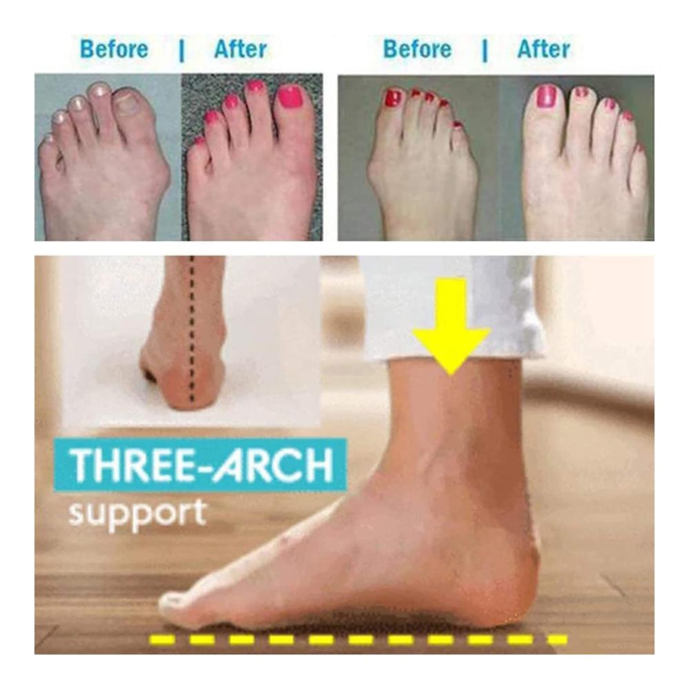 Orthopädische Damen-Sandalen Sommerkomfort für Hallux Valgus - Leichte Strand-Hausschuhe mit Zehenkorrektor - Gelb - Größe 38 EU